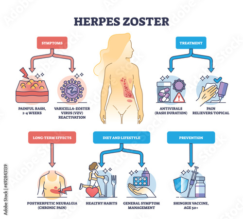 Herpes zoster infection medical symptoms and treatment outline diagram. Labeled educational scheme with skin shingle prevention, diet, lifestyle and long term effects explanation vector illustration. photo