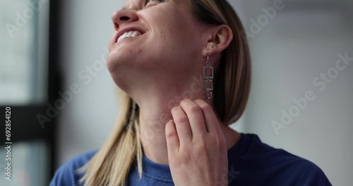 Closeup of unhealthy young woman with allergy symptoms and scratching neck photo