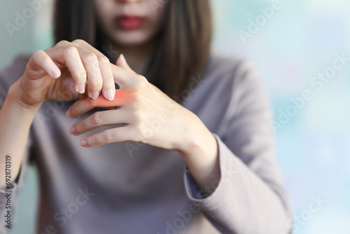 Woman has finger joint pain due to rheumatoid arthritis. Health care concept.