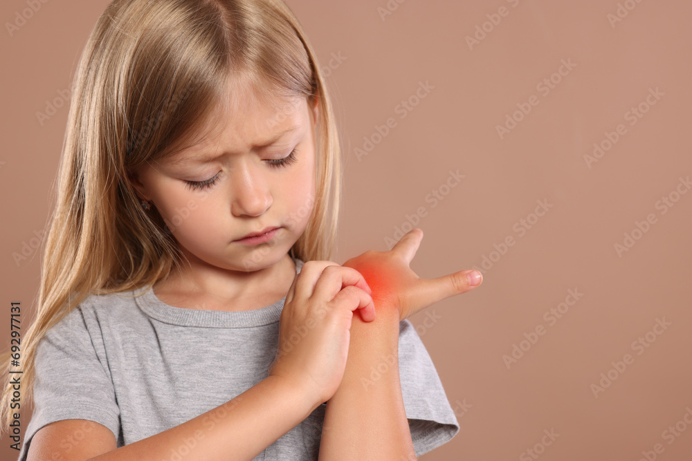 Suffering from allergy. Little girl scratching her hand on light brown background, space for text Suffering from allergy. Little girl scratching her hand on light brown background, space for text