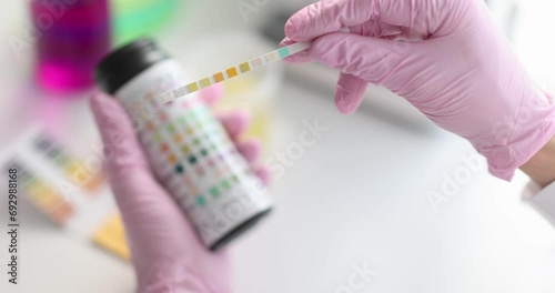 Hands in gloves hold test strips, close-up, slow motion. water ph indicator, medical laboratory, diabetes photo