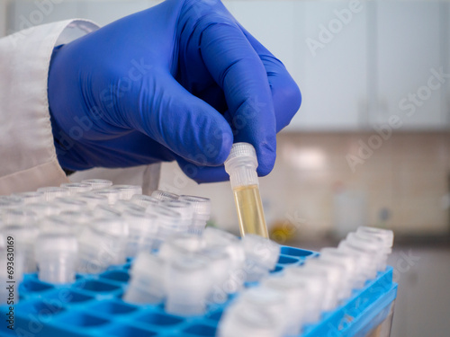 A yellow substance in a test tube, a scientist takes out one test tube from a set of test tubes in a box, close-up.