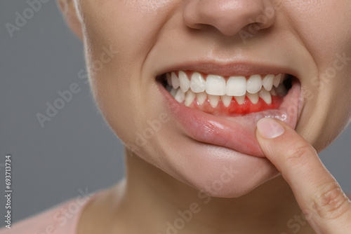 Woman showing inflamed gum on grey background  closeup