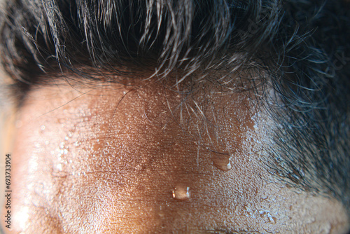 Photos closeup of sweat on forehead against dark background ,