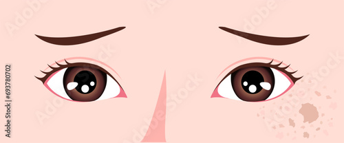 Vector illustration of normal facial skin and facial skin with spots. photo