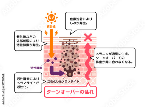 しみの発生メカニズム ベクターイラスト（解説文付き）