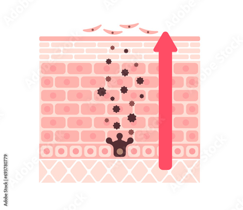 Vector illustration of normal skin turnover
