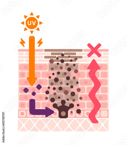 Vector illustration of how skin spots (hyperpigmentation) are created.