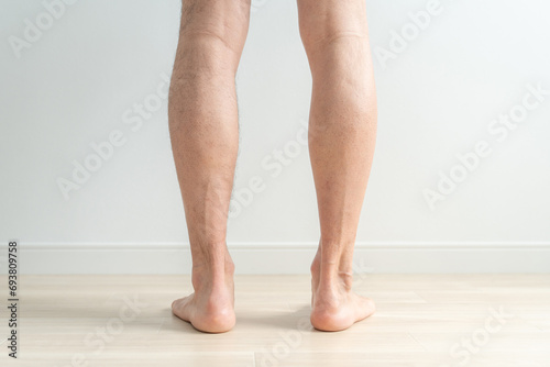 男性のムダ毛・脱毛・剃毛のイメージ（脱毛した脚としていない脚）  © buritora