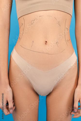 Close up of woman body with marks on stomach. Isolated on blue background. Beauty care, anti aging procedures, plastic surgery concept