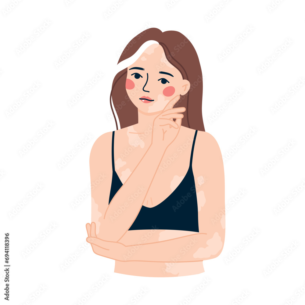 Vector illustration portrait of a beautiful girl with vitiligo. The concept of accepting yourself and your body. Body positivity. Vector illustration portrait of a beautiful girl with vitiligo. The concept of accepting yourself and your body. Body positivity.