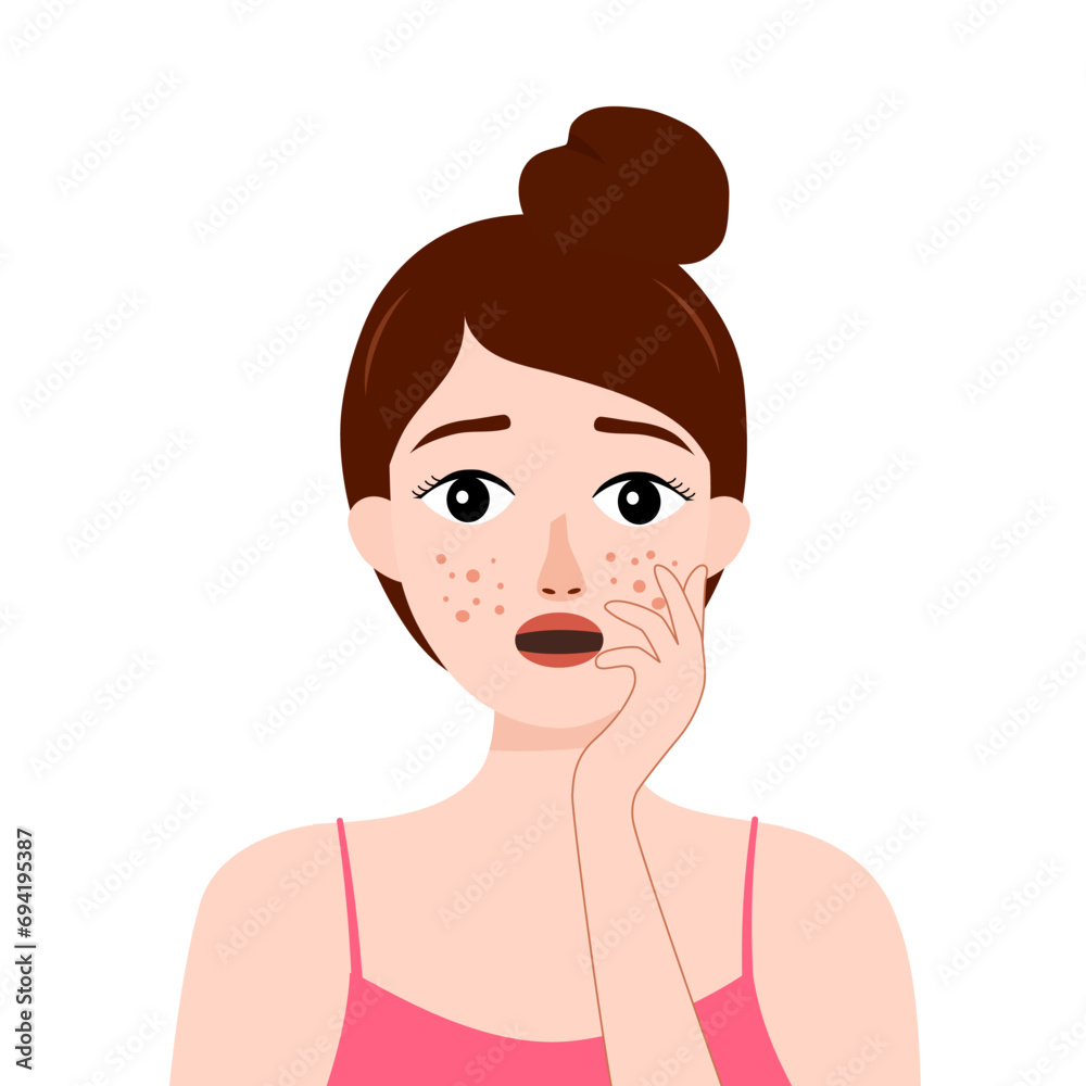 Woman with acne or allergy pimples touches her face. Young girl with skin problems. Skincare and dermatology concept. Woman with acne or allergy pimples touches her face. Young girl with skin problems. Skincare and dermatology concept.