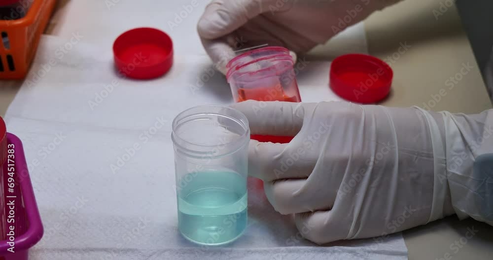 The laboratory assistant prepares a blood smear, staining it using the