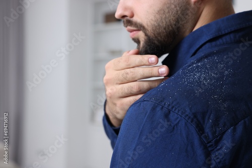Man brushing dandruff off his shirt indoors, closeup. Space for text photo