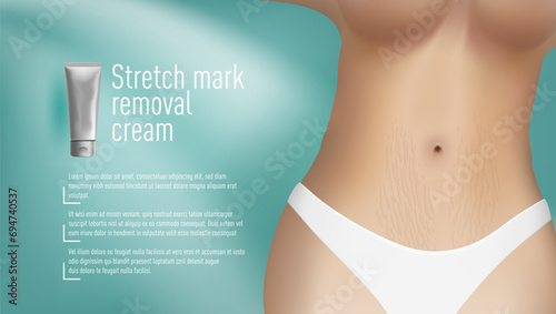 Stretch Mark Removal Cream. Skin Care Ad Template