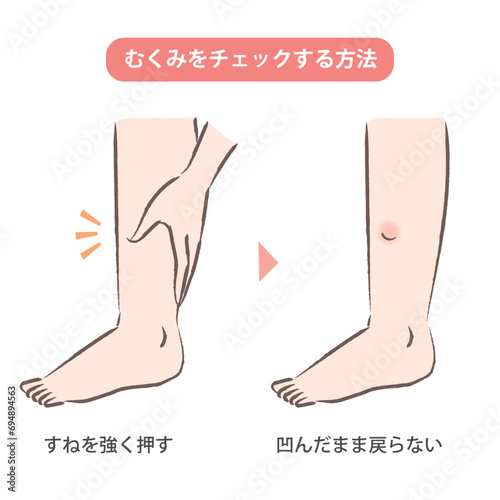 足の浮腫をセルフチェックする方法のイラスト