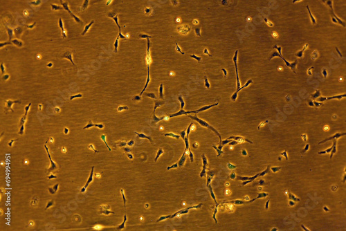 Adherent cells in culture transfected with a Green Fluorescent Protein (GFP)producing plasmid - view under visible light and fluorescent light photo