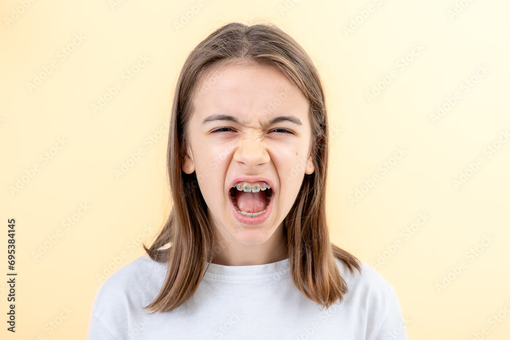 A teenage girl with braces screams with her mouth wide open. A teenage girl with braces screams with her mouth wide open.