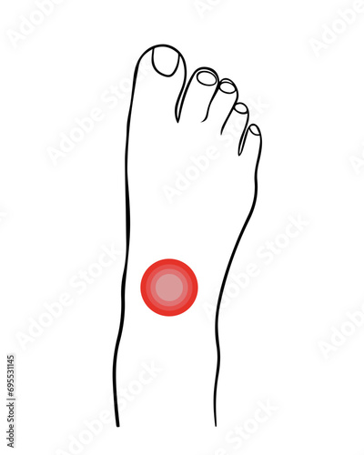 Vector isolated illustration of ankle pain.