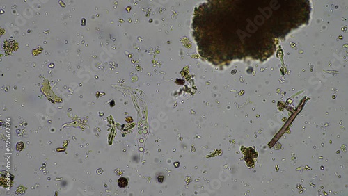 soil microorganisms under the microscope, including, fungi hyphae photo