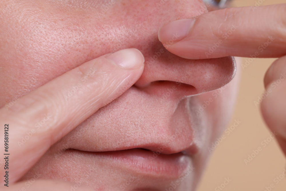 Woman popping pimple on her nose against beige background, closeup Woman popping pimple on her nose against beige background, closeup