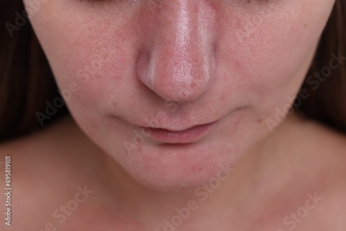 Closeup view of woman with blackheads on her nose photo