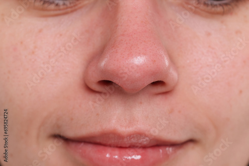 Closeup view of woman with blackheads on her nose