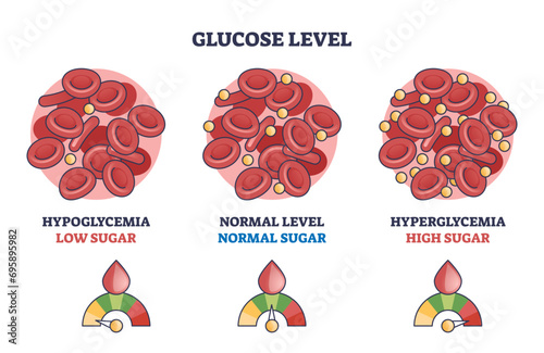 Glucose level with low, normal and high sugar in blood outline diagram. Labeled educational scheme with hypoglycemia and hyperglycemia problem monitoring vector illustration. Cardiovascular health.