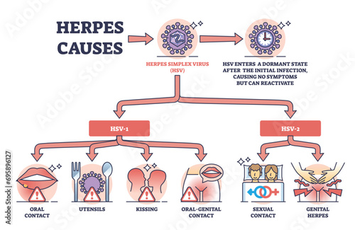 Herpes causes and medical skin HSV virus transmission outline diagram. Labeled educational list with dermatological problem activation causes vector illustration. Oral kissing and sexual contact.