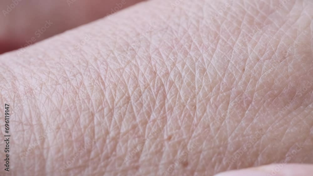 closeup female hands 55 years old with dry skin damage, beauty and skincare in second half life, concept care aging skin, treatment dermatological diseases, hydration and nutrition of epidermis closeup female hands 55 years old with dry skin damage, beauty and skincare in second half life, concept care aging skin, treatment dermatological diseases, hydration and nutrition of epidermis