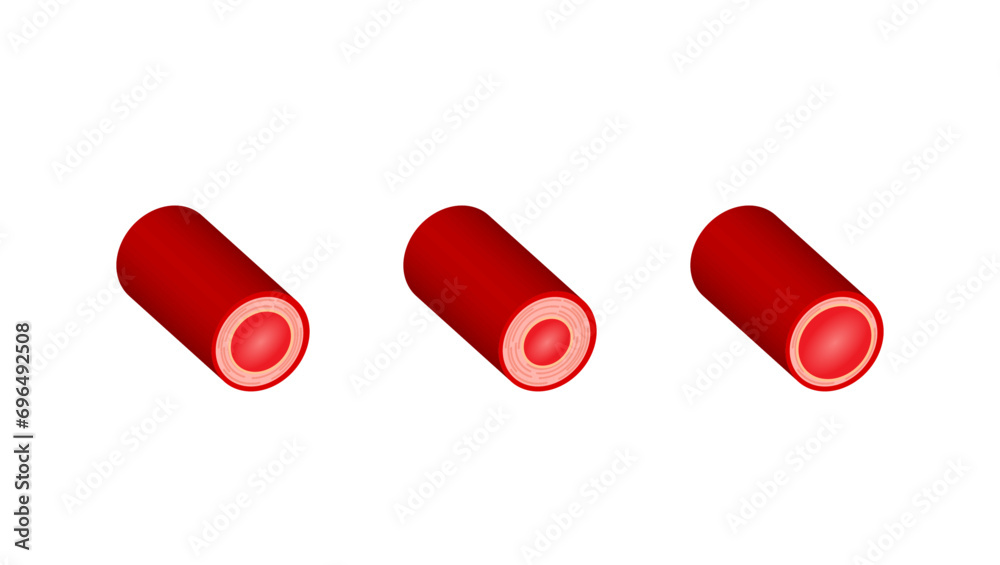 Arterial vasoconstriction and vasodilation. Cross section of arteries ...