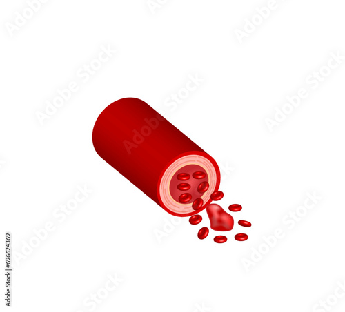 Thromboembolism. Circulating blood clot. Normal blood flow and a thrombus in blood flow, embolus. Red blood cell. Vector illustration.