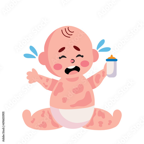kawasaki disease baby