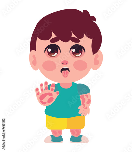 kawasaki disease boy