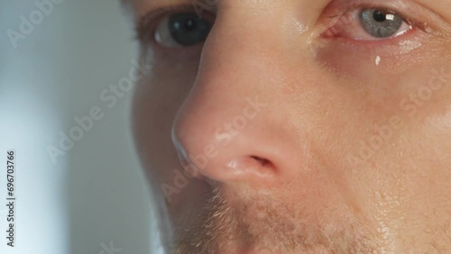 Man Alleviates Symptoms with Nasal Spray, closeup 60 fps
