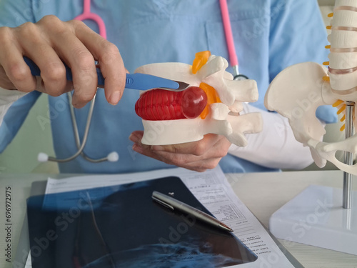 фотографія Intervertebral hernia and surgery concept