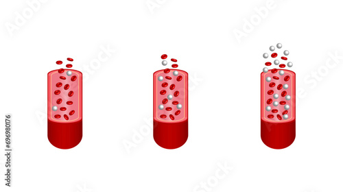 Blood Glucose Levels. Normal level, hypoglycemia (low blood sugar), hyperglycemia (high blood sugar), sugar test. vector diagram