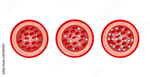 Blood Glucose Levels. Normal level, hypoglycemia (low blood sugar), hyperglycemia (high blood sugar), sugar test. vector diagram