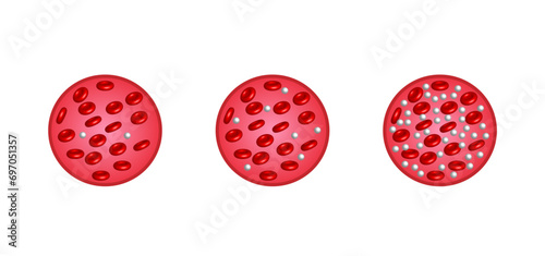 Blood Glucose Levels. Normal level, hypoglycemia (low blood sugar), hyperglycemia (high blood sugar), sugar test. vector diagram