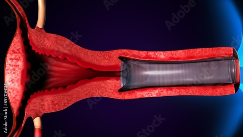female reproductive,ovary and vagina system anatomy. 3d illustration photo