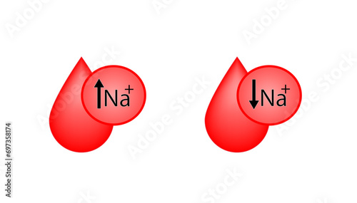 Hypernatremia, high plasma sodium level and Hyponatremia, low plasma sodium level. Sodium Na excess and deficit electrolyte disorders. Scientific design. Vector illustration.