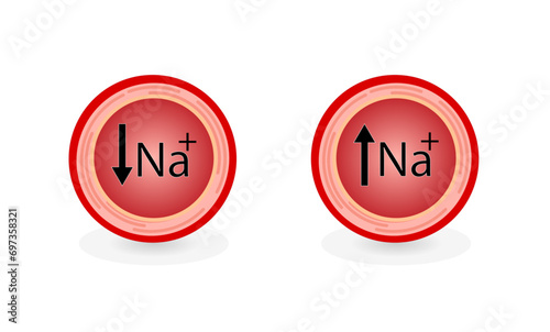 Hypernatremia, high plasma sodium level and Hyponatremia, low plasma sodium level. Sodium Na excess and deficit electrolyte disorders, blood test tube, Scientific design. Vector illustration.