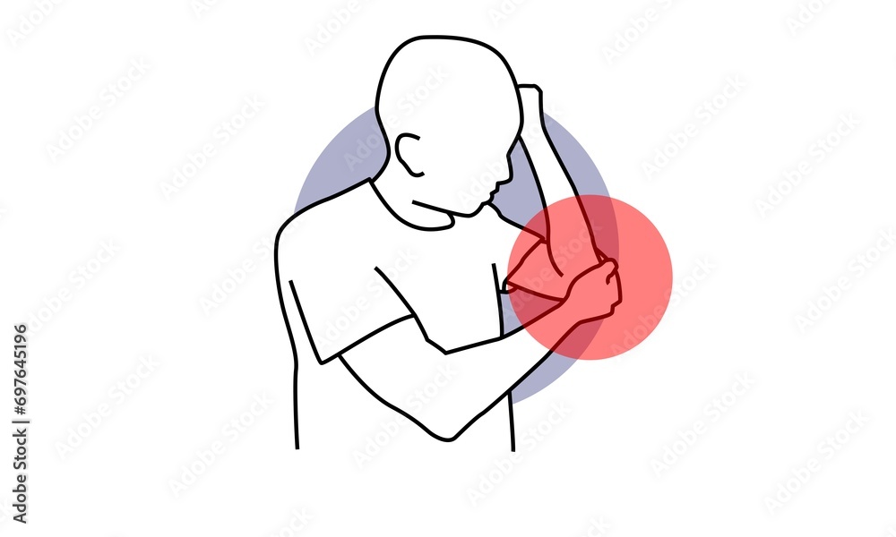 Golfer's elbow pain sport injury in pronation wrist common radial