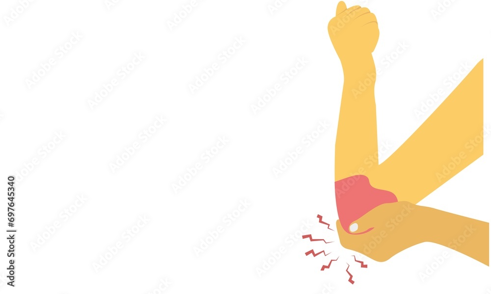 Golfer's elbow pain sport injury in pronation wrist common radial