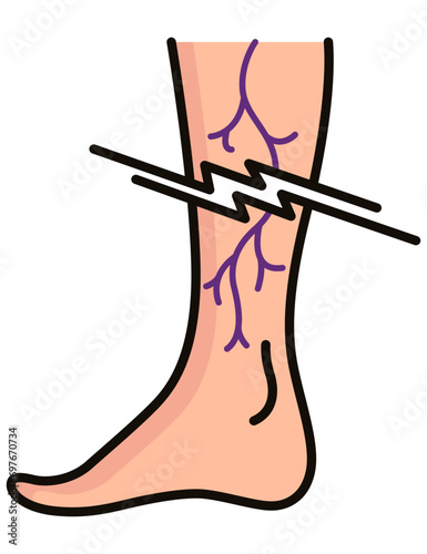 Varicose treatment icon. Violation of circulatory system. Vascular disease diagnostic. Venous insufficiency medical disease. Vector illustration