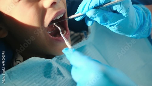 Compassionate female dentist assesses tooth decay in a young patient using a dental probe and angled mirror. photo
