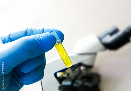 Scientist holding Pleural fluid for microscopic examination including Malignant cell, Gram stain, cytology. photo