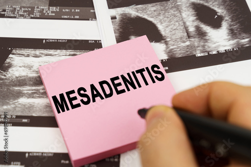 On the ultrasound pictures there are stickers that say - mesadenitis photo