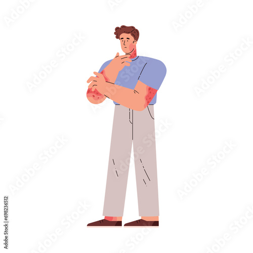Suffering man scratching the skin on hand, skin problems allergies, psoriasis, atopic dermatitis vector illustration