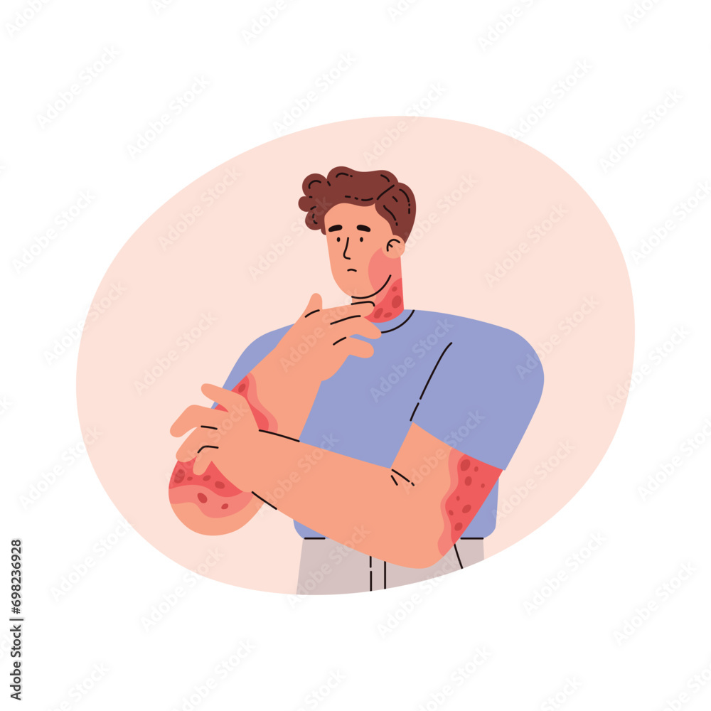 Man with skin problem on hands. Vector illustration in flat style.